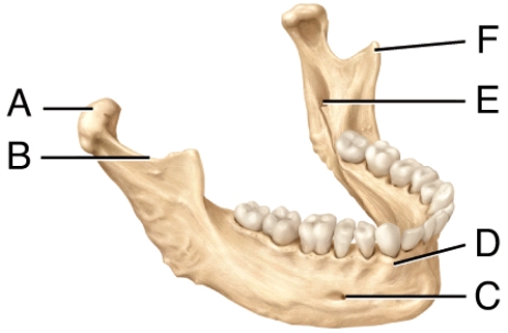 Where is the mandibular notch in the diagram?  