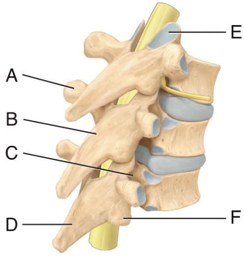 In the diagram, where is the pedicle of the vertebral arch?