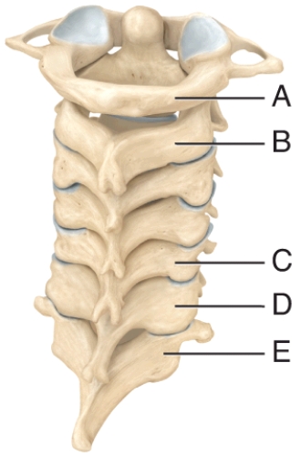 Which of the cervical vertebra is responsible for the ability to move your head from side to side signifying no?