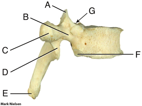 Where is the superior vertebral notch?  