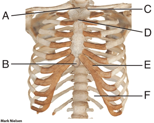 In the diagram, which part is most often broken during CPR?