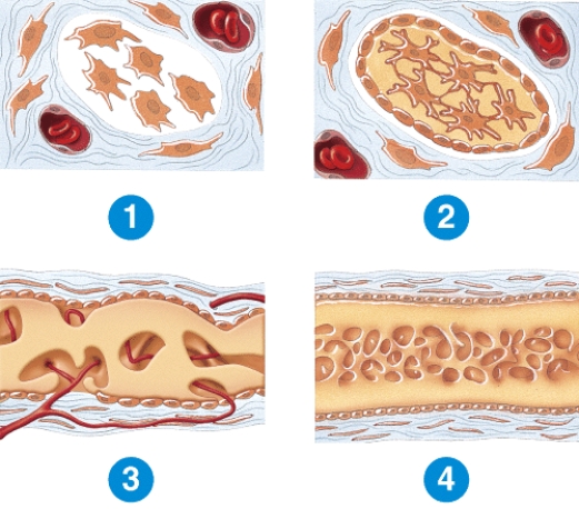Briefly describe what is happening in each of the stages below.