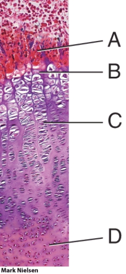 <strong>In the diagram, where is the zone of hypertrophic cartilage? </strong> A) A B) B C) C D) D E) E