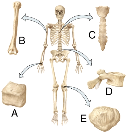 <strong>In the diagram, which bone is the flat bone? </strong> A) A B) B C) C D) D E) E