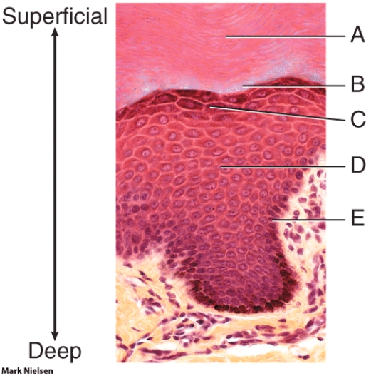 <strong>In the photo, which layer is the stratum spinosum? </strong> A) A B) B C) C D) D E) E