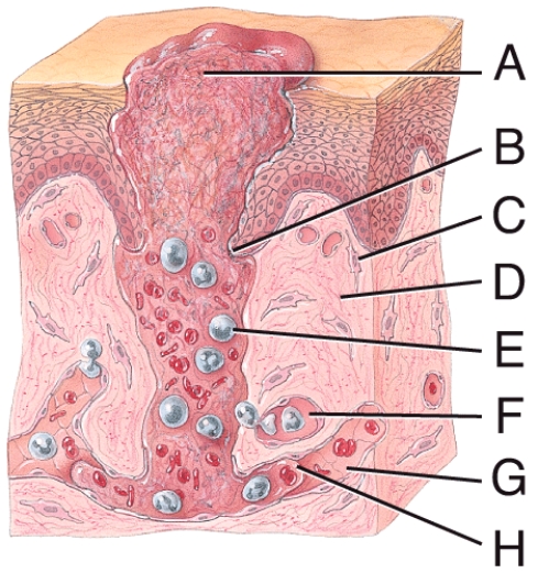<strong>In the diagram of the inflammatory phase of deep wound healing, where is the blood clot? </strong> A) A B) C C) D D) G E) H