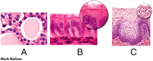 <strong>Which of these is a ciliated epithelial tissue? </strong> A) A B) B C) C D) A and B E) None of these choices