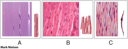 <strong>Which of the diagrams in the figure shown above is a skeletal muscle tissue? </strong> A) A only B) B only C) C only D) A and B E) None of these choices
