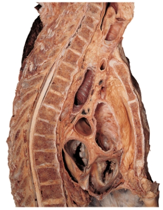 <strong>Along which of the following body planes has this section been made? </strong> A) oblique B) frontal C) sagittal D) coronal E) transverse