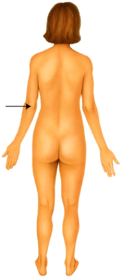 <strong>Which of the following anatomical terms best describes the indicated region? </strong> A) popliteal B) mental C) crural D) olecranal E) occipital