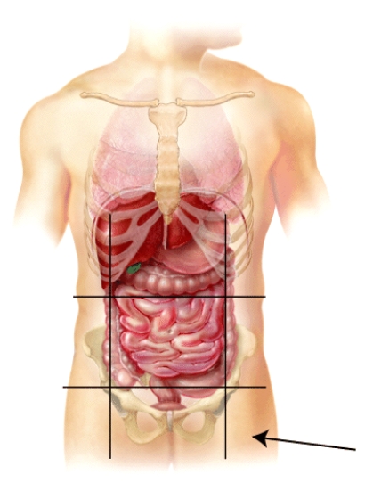 <strong>What is the name of this region? </strong> A) left hypochondriac B) right Lumbar C) left inguinal D) hypogastric E) mental