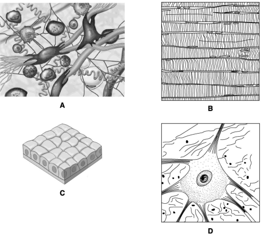 Match each of the following diagrams in the figure below to the type of tissue it represents. connective