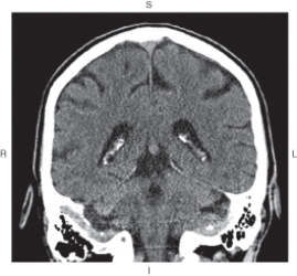 <strong>The figure below illustrates which of the following imaging planes? </strong> A) Axial B) Coronal C) Sagittal D) Oblique