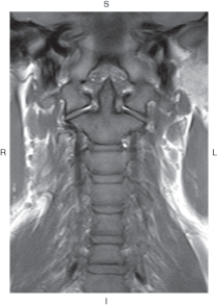 <strong>The figure below illustrates which of the following imaging planes? </strong> A) Axial B) Coronal C) Sagittal D) Oblique