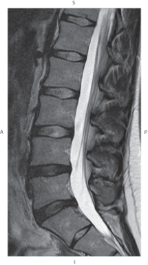 <strong>The figure below illustrates which of the following imaging planes? </strong> A) Axial B) Coronal C) Sagittal D) Oblique