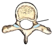 <strong>The part identified in this figure is the: </strong> A) body. B) lamina. C) pedicle. D) transverse process.