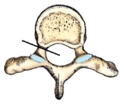<strong>The part identified in this figure is the: </strong> A) vertebral arch. B) vertebral foramen. C) intervertebral foramina. D) transverse foramen.