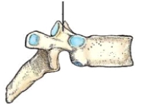 <strong>The part identified in this figure is the: </strong> A) lamina. B) pedicle. C) superior articular process. D) inferior articular process.