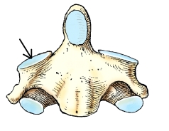 <strong>The part identified by the arrow on the vertebra in this figure is the: </strong> A) superior articular process. B) inferior articular process. C) transverse process. D) lateral mass.