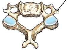 <strong>The bony part identified in this figure is the: </strong> A) spinous process. B) transverse process. C) pedicle. D) lamina.