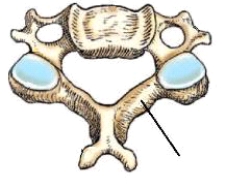 <strong>The bony part identified in this figure is the: </strong> A) lamina. B) pedicle. C) superior articular process. D) inferior articular process.