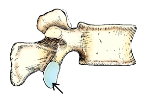 <strong>The part on the lumbar vertebra identified in this figure is the: </strong> A) superior vertebral notch. B) inferior vertebral notch. C) superior articular process. D) inferior articular process.