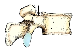 <strong>The part identified on the lumbar vertebra in this figure is the: </strong> A) superior vertebral notch. B) inferior vertebral notch. C) superior articular process. D) inferior articular process.