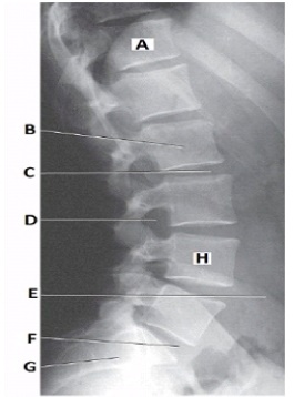What anatomy is labeled with the letter C in the image below?