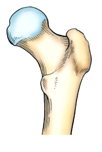 <strong>The aspect of the proximal femur shown in this figure is the:  </strong> A) posterior. B) anterior. C) lateral. D) medial. <div style=padding-top: 35px> 