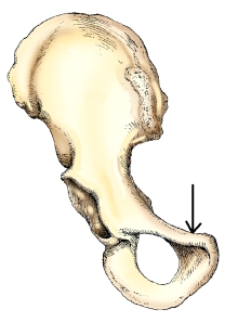 <strong>Which ramus is labeled with the arrow in this figure?  </strong> A) Superior pubic B) Inferior pubic C) Superior ischial D) Inferior ischial <div style=padding-top: 35px> 