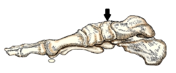 <strong>The bone of the foot indicated by the arrow in this figure is the:  </strong> A) navicular. B) talus. C) calcaneus. D) medial cuneiform. <div style=padding-top: 35px> 