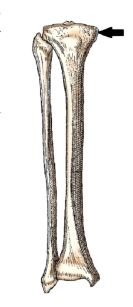 <strong>The bone part identified by the arrow in this figure is the:  </strong> A) medial epicondyle. B) tibial tuberosity. C) medial malleolus. D) medial condyle. <div style=padding-top: 35px> 