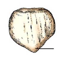 <strong>The area identified on the patella in this figure is the:  </strong> A) apex. B) base. C) inferior articulating surface. D) superior articulating surface. <div style=padding-top: 35px> 