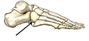 <strong>The bone identified by the arrow in this figure is the:  </strong> A) tibia. B) cuboid. C) talus. D) navicular. <div style=padding-top: 35px> 