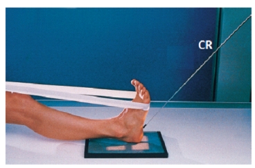 <strong>Which projection is demonstrated in this photograph?  </strong> A) PA foot B) AP axial foot C) Axial calcaneus (plantodorsal) D) Axial calcaneus (dorsoplantar) <div style=padding-top: 35px> 
