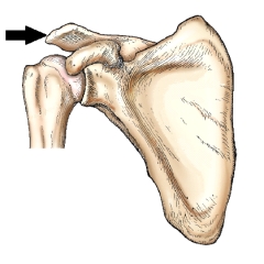 <strong>The part identified by the arrow in this figure is the: </strong> A) acromion. B) coracoid process. C) glenoid cavity. D) superior border.