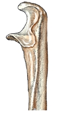 <strong>The bone part shown in this figure is the:  </strong> A) distal ulna. B) proximal ulna. C) distal radius. D) proximal radius. <div style=padding-top: 35px> 