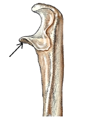 <strong>The bone part labeled with the arrow in this figure is the:  </strong> A) radial notch. B) trochlear notch. C) coronoid process. D) olecranon process. <div style=padding-top: 35px> 