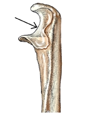<strong>The area on the bone labeled with the arrow is this figure is the:  </strong> A) radial notch. B) trochlear notch. C) coronoid process. D) olecranon process. <div style=padding-top: 35px> 