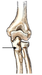 <strong>The bone indicated by the arrow in this figure is the:  </strong> A) ulna. B) radius. C) tibia. D) humerus. <div style=padding-top: 35px> 