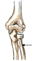 <strong>The bone identified by the arrow in this figure is the:  </strong> A) ulna. B) radius. C) fibula. D) humerus. <div style=padding-top: 35px> 