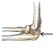 <strong>The bone part identified by the arrow in this figure is the:  </strong> A) trochlea. B) capitulum. C) radial head. D) olecranon process. <div style=padding-top: 35px> 