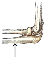 <strong>The bone or bone part identified by the arrow in this figure is the:  </strong> A) ulna. B) radius. C) humerus. D) olecranon process. <div style=padding-top: 35px> 