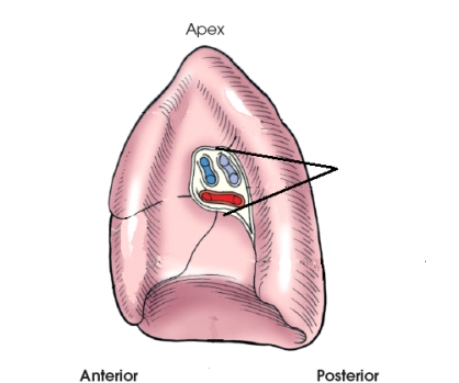 <strong>The area identified in this figure is the:  </strong> A) hilum. B) lingula. C) mediastinum. D) pulmonary veins. <div style=padding-top: 35px> 