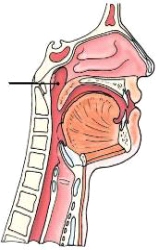 <strong>The anatomy identified on the lateral neck above is the:  </strong> A) oropharynx. B) nasopharynx. C) soft palate. D) epiglottis. <div style=padding-top: 35px> 