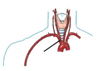 <strong>The artery identified in the figure below is the: </strong> A) brachiocephalic. B) left subclavian. C) right subclavian. D) right common carotid.