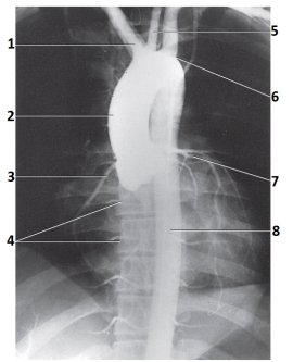 <strong>The artery labeled 6 in this figure is the _____ artery. </strong> A) brachiocephalic B) left common carotid C) left subclavian D) left coronary