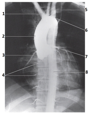 <strong>The artery labeled as 3 in this figure is the: </strong> A) brachiocephalic. B) right coronary. C) right intercostal. D) ascending aorta.