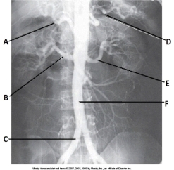 <strong>Letter A in the abdominal aortogram image below is the _____ artery. </strong> A) splenic B) celiac C) R renal D) hepatic