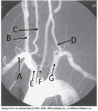 <strong>Letter B in the angiographic image of the aortic arch and its branches below is the _____ artery. </strong> A) innominate (brachiocephalic) B) R common carotid C) R subclavian D) R vertebral